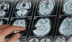 Científicos de Londres identifican la señal cerebral que ayuda a entender nuestro entorno.