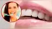 Conoce cómo puedes blanquear tus dientes de forma natural.