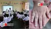 Minedu y Minsa activan protocolos ante aumento de casos del virus Coxsackie en colegios de Lima Metropolitana.