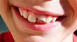Científicos japoneses descubren cómo hacer que los dientes crezcan de nuevo