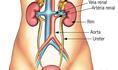 ¿Qué es el sistema urinario y sus funciones en el cuerpo humano?