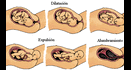Aprende sobre la Reproducción Humana: El parto