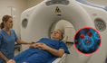 ¡Inesperado riesgo! Abuso de tomografías computarizadas podría aumentar miles de casos de cáncer, según estudio