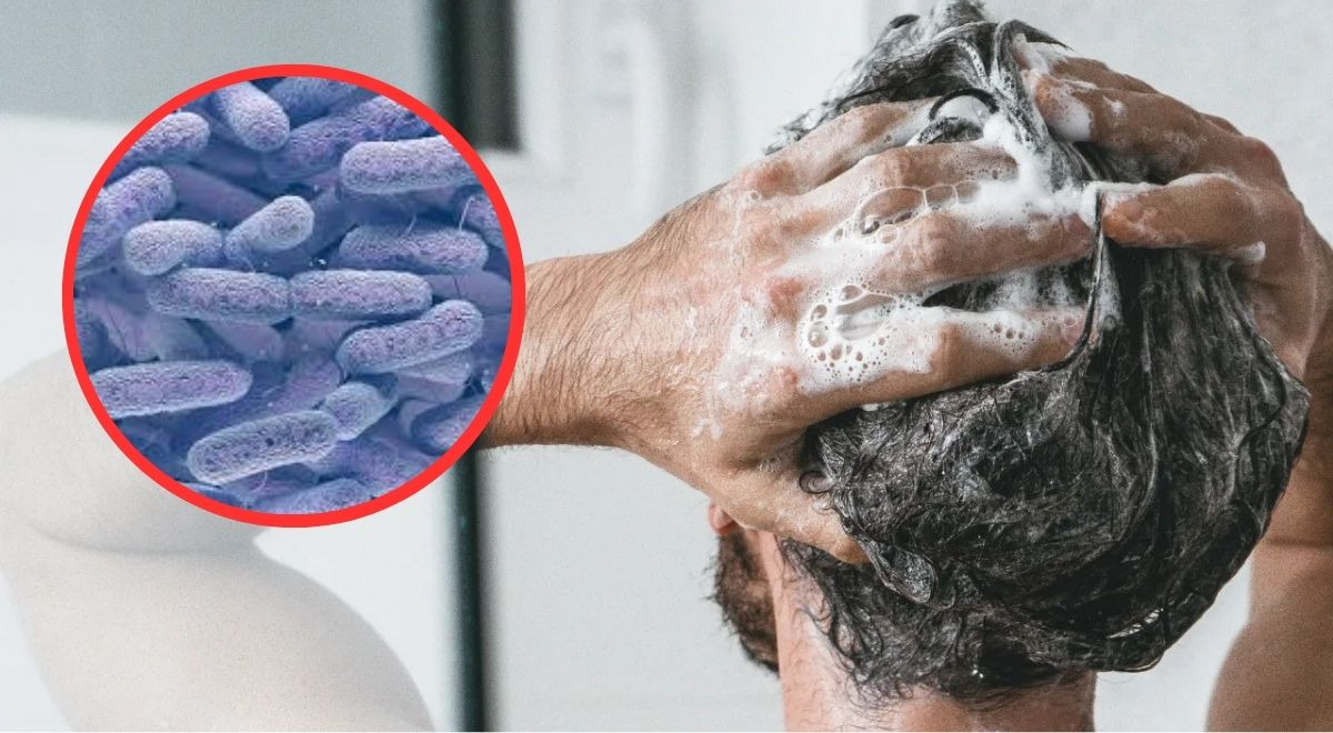 Detectan BACTERIA PELIGROSA en famoso shampoo que muchos usan: retiran miles de botellas del mercado