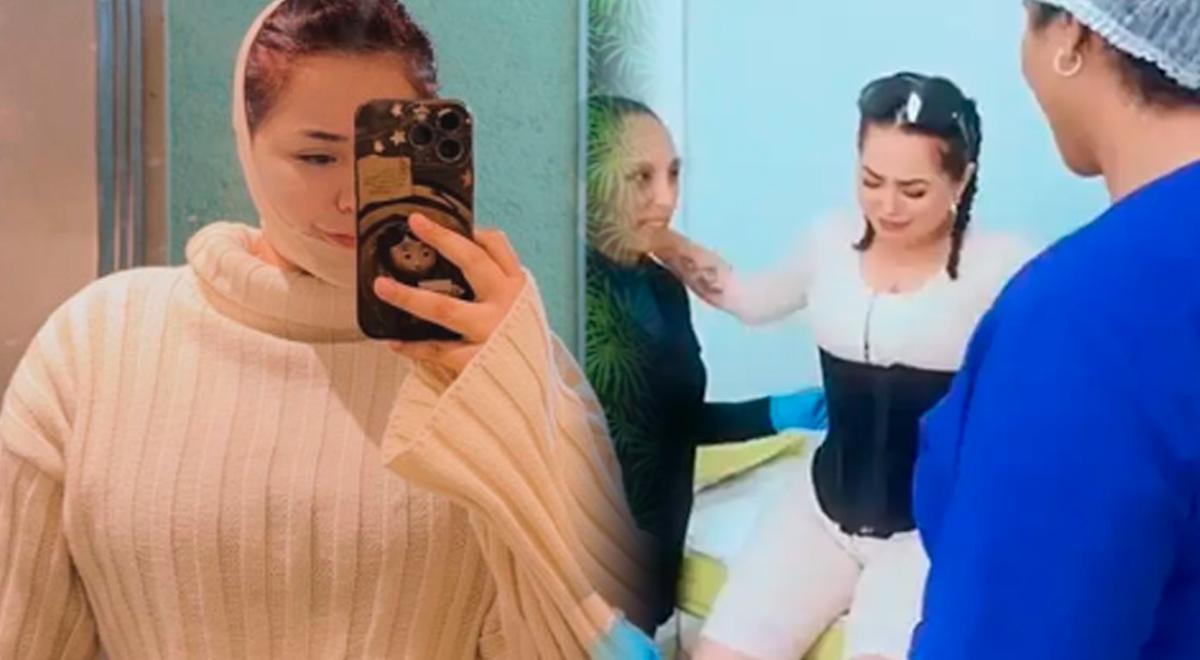 Ana Lucia Urbina, da Corazon Serrano, submetida a cirurgia estética, revela seu processo: “drenagem linfática” Ana Lucia Urbina, da Corazon Serrano, submetida a cirurgia estética, revela seu processo: “drenagem linfática”