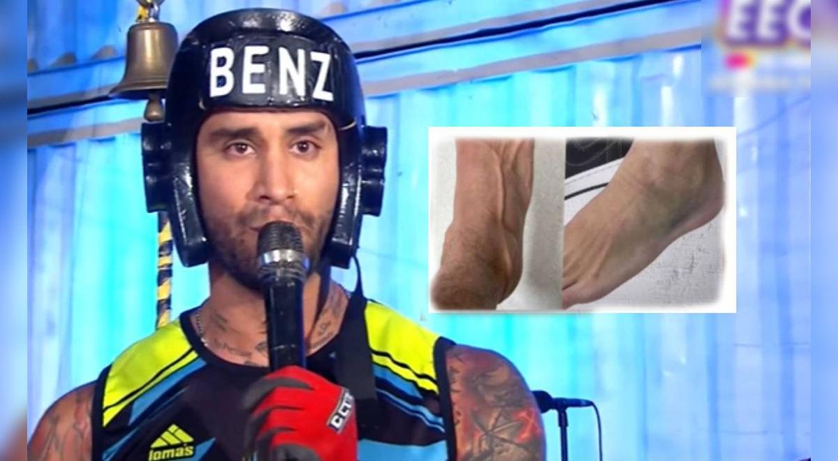 Ele estará nas finais do EEG? Jota Benz incomoda seus seguidores ao revelar a gravidade de seu estado de saúde