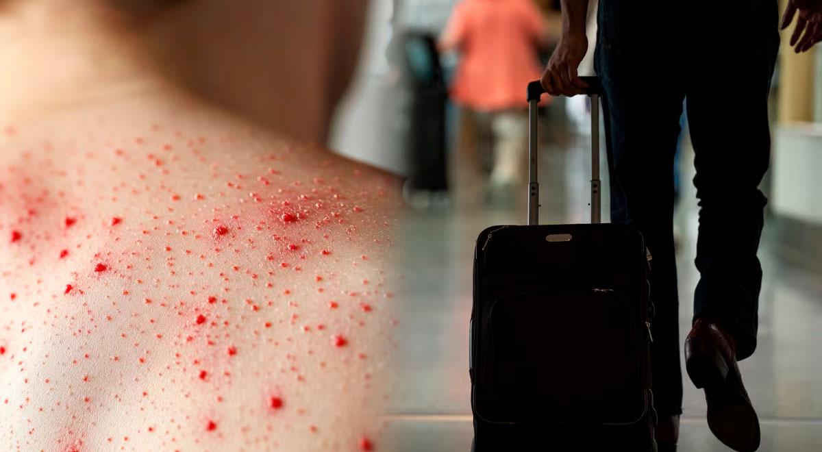 Aviso! Novo vírus nos EUA | Aeroportos do país devem reportar os infectados: Aqui estão os sintomas iniciais