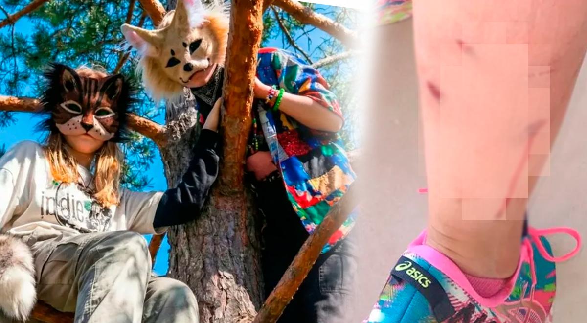 Menor atacado por Therian! Mãe relata que filha foi mordida por jovens que acreditavam ser animais: “Ela achou que estavam brincando”