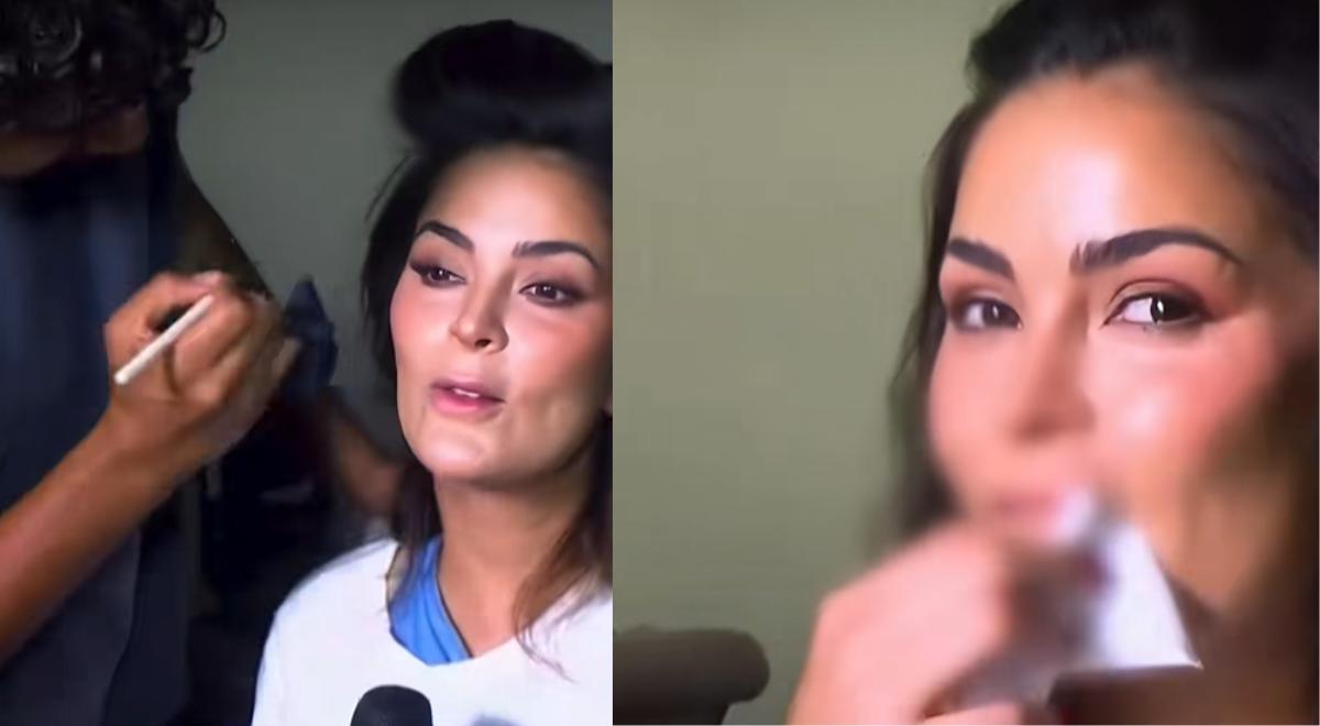 Laura Spoa, que ficou com um dente quebrado após um grave acidente, explica por que não fez a cirurgia