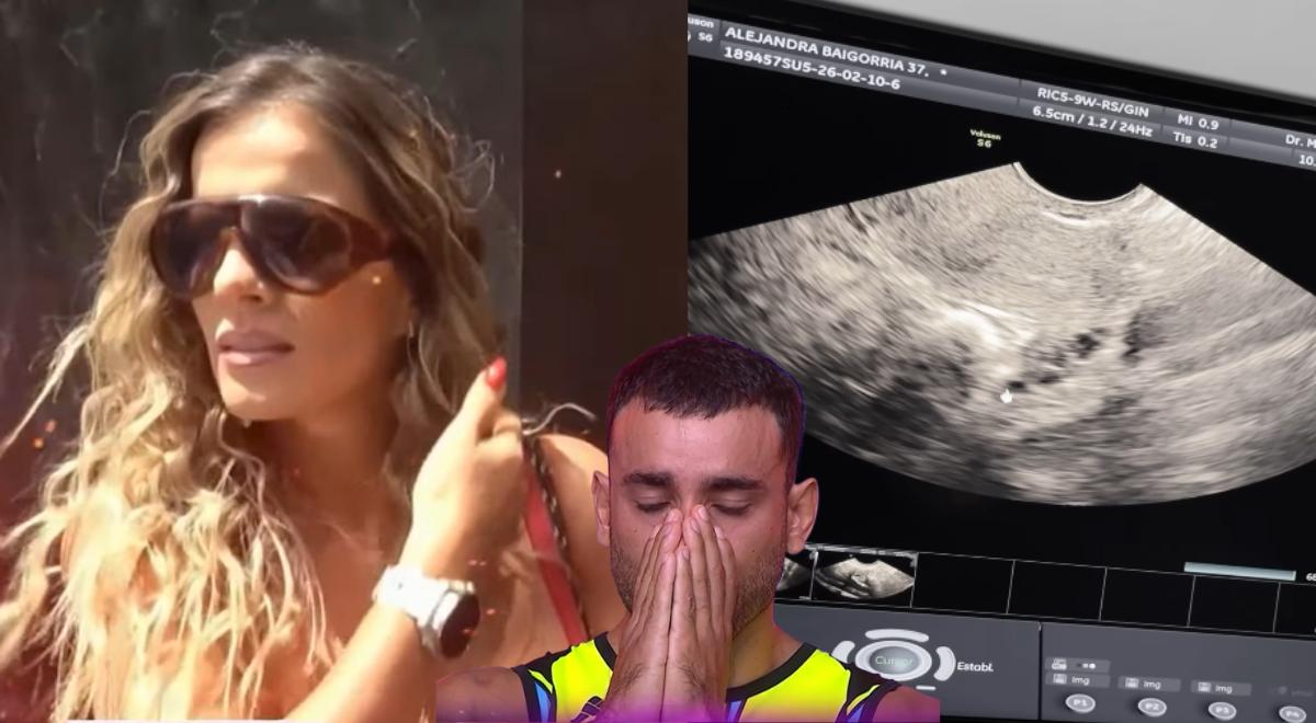 Alejandra Baigorria esclarece: Você não precisa de companheiro para ser mãe, revela quantos ovos ela congelou