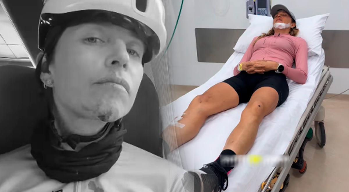 Anna Karina Coppolo publie une vidéo poignante sur l’horrible accident qu’elle a subi et qui l’a envoyée aux urgences : “Parfois…”