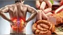 ¿Problemas renales? Estos alimentos podría estar afectando tus riñones, según expertos