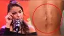 Laura Spoya DEJA EN SHOCK al reaparecer y mostrar cómo quedó su espalda tras su operación