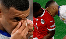 Kylian Mbappé se perdería la Eurocopa tras sufrir una grave fractura: el jugador será operado