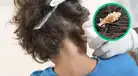 ¡Rápido y fácil! Trucos caseros para eliminar los piojos y liendres en un solo día