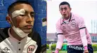 Ministerio Público abrió investigación por agresión a jugador de Sport Boys