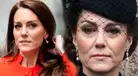 ¿Por qué Kate Middleton tiene una cicatriz en la cabeza? Conoce su origen y significado