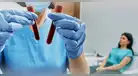 Un simple análisis de sangre podría revolucionar el diagnóstico de leucemia, según investigación