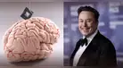 ¿El fin de la ceguera? Elon Musk promete devolver la visión con chips cerebrales de Neuralink