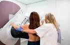 Cáncer de mama: una mamografía a tiempo podría salvar a 7800  peruanas en el 2025