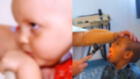 Leucemia en niños: ¿Cuáles son los factores de riesgo?