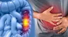 Cáncer de colon: estos son los síntomas que alertan de la enfermedad