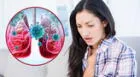Cáncer de pulmón: ¿cuáles son los síntomas principales en mujeres?
