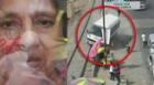 Ate: Mujer es arrollada por "Chosicano" y se salva de milagro, pero quedó gravemente herida