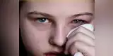 Ten cuidado con peligrosa conjuntivitis