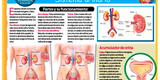 Cuerpo humano: ¿Cuáles son los componentes del aparato urinario?
