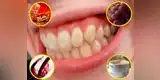 Salud: ¿Por qué los dientes se ponen amarillos?