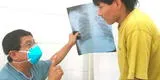 Día Mundial de Lucha Contra la Tuberculosis: Conoce las personas propensas a contagio