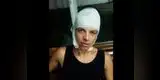 Niño transmite en vivo cuando se dispara en la cabeza y sobrevive [VIDEO]