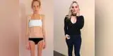 Joven sufría de anorexia y su padre tuvo ejemplar accionar que la salvó [FOTOS]