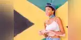 Instagram: Modelo con vitíligo se muestra como dios la trajo al mundo [FOTO]