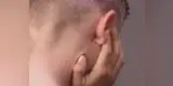 YouTube: Médicos examinaron la oreja de un hombre y lo que encontraron fue sorprendente [VIDEO]