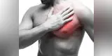 Cuatro cosas que debes de hacer para evitar un infarto