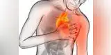 Siete signos que indican que te podría dar un ataque al corazón 