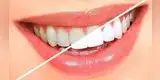 Salud: 5 recetas naturales para blanquear los dientes