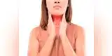 Salud: Aprende a reconocer los signos de alerta  del cáncer de garganta