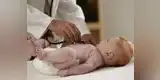 Claves para tratar la diarrea infantil