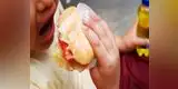 Minsa advierte que 2.5 millones de niños tienen sobrepeso y obesidad