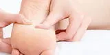 Salud: Plantas de los pies amarillas, ¿por qué ocurre?