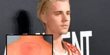 Justin Bieber reveló que sufre la enfermedad de Lyme: ¿Qué es y qué síntomas presenta? [FOTOS]