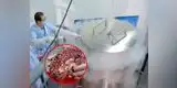 Facebook: Empresa extranjera almacena cerebros y cuerpos congelados para “resucitarlos” en el futuro 