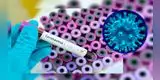 El coronavirus muta: Científicos revelan dos cepas, una es más agresiva [VIDEO]