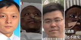 Médicos de China tienen extraño cambio de color en la piel tras sobrevivir al coronavirus