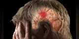 Coronavirus: Estudio de Oxford señala que la COVID-19 aumenta el riesgo de accidentes cerebrovasculares