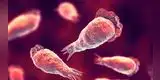 Estados Unidos: Confirman un caso de infección de la ameba “come cerebros” [FOTO]
