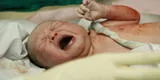 Maternidad: ¿Por qué se enreda el feto con el cordón umbilical?